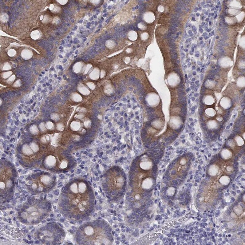PKC zeta Antibody - BSA Free Immunohistochemistry-Paraffin: PKC zeta Antibody [NBP1-87270]