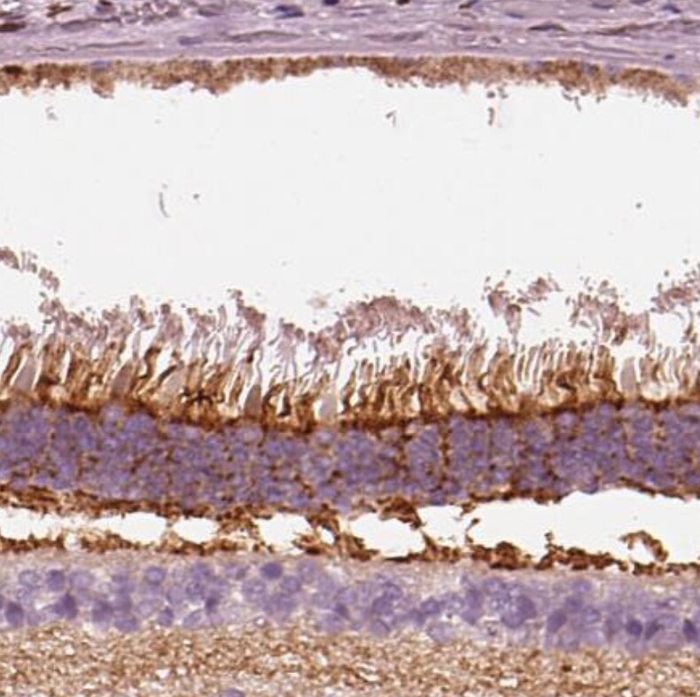 PKC zeta Antibody - BSA Free Immunohistochemistry-Paraffin: PKC zeta Antibody [NBP1-87270]