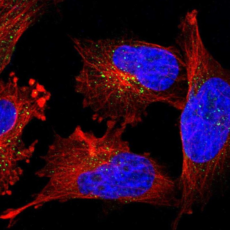 PIG3 Antibody - BSA Free Immunocytochemistry/ Immunofluorescence: PIG3 Antibody [NBP1-87275]
