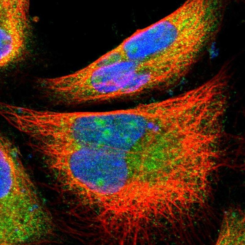 PFDN1 Antibody - BSA Free Immunocytochemistry/ Immunofluorescence: PFDN1 Antibody [NBP1-87294]