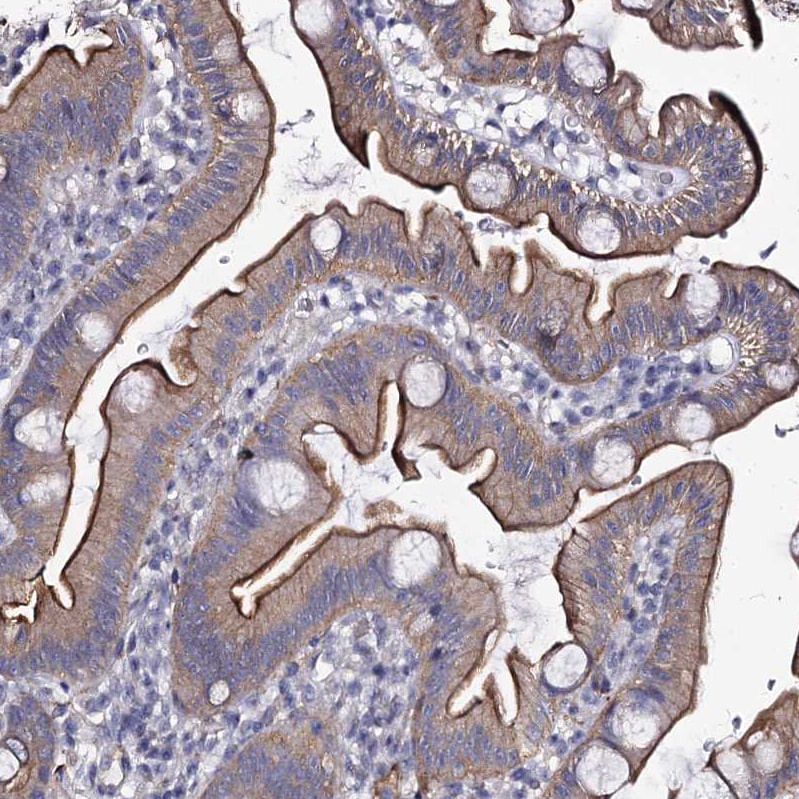 CBFB Antibody - BSA Free Immunohistochemistry-Paraffin: CBFB Antibody [NBP1-87300]