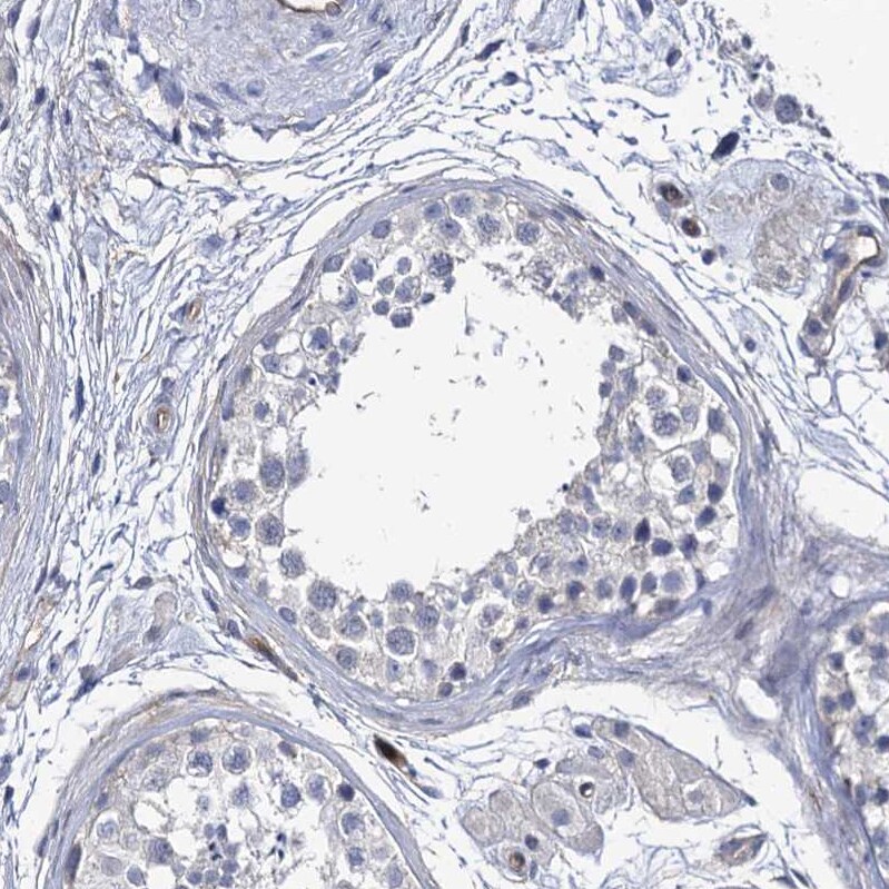 CBFB Antibody - BSA Free Immunohistochemistry-Paraffin: CBFB Antibody [NBP1-87300]
