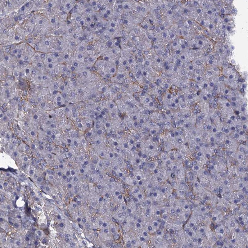 CBFB Antibody - BSA Free Immunohistochemistry-Paraffin: CBFB Antibody [NBP1-87300]