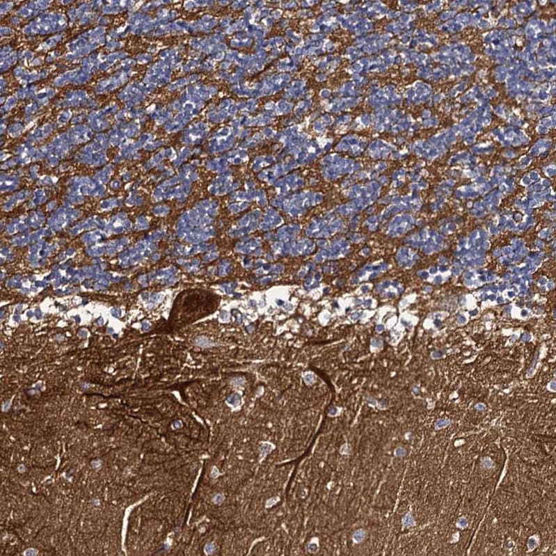CBFB Antibody - BSA Free Immunohistochemistry-Paraffin: CBFB Antibody [NBP1-87300]