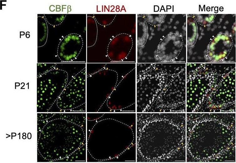 CBFB Antibody - BSA Free