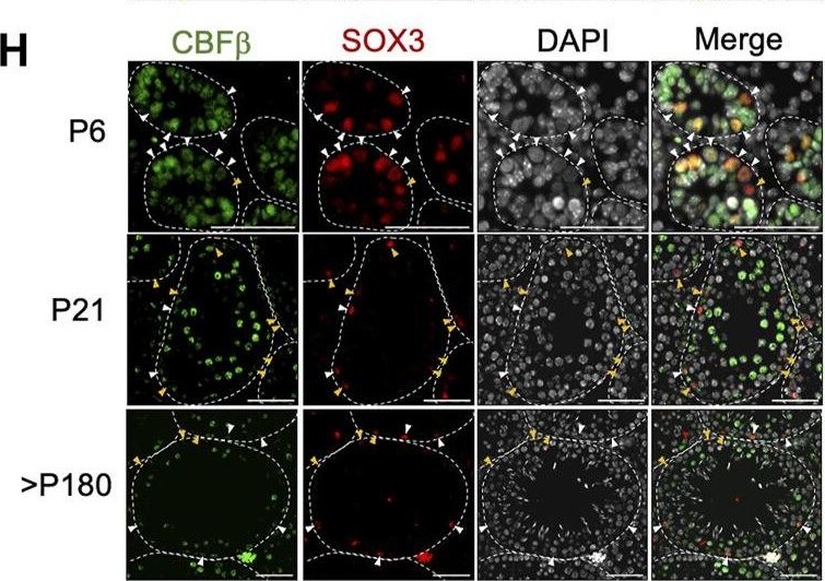 CBFB Antibody - BSA Free
