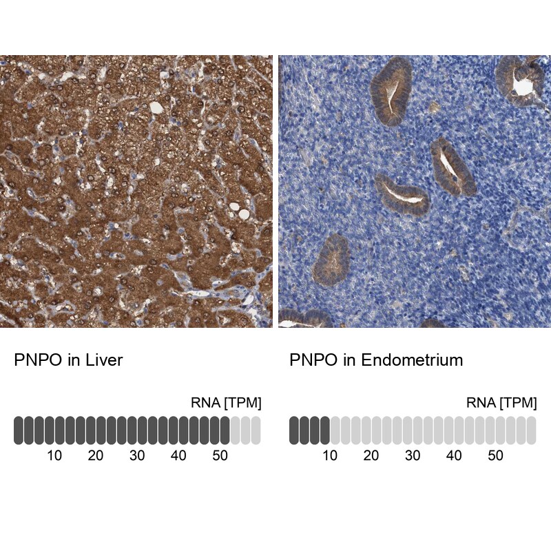 PNPO Antibody - BSA Free Immunohistochemistry-Paraffin: PNPO Antibody [NBP1-87303]