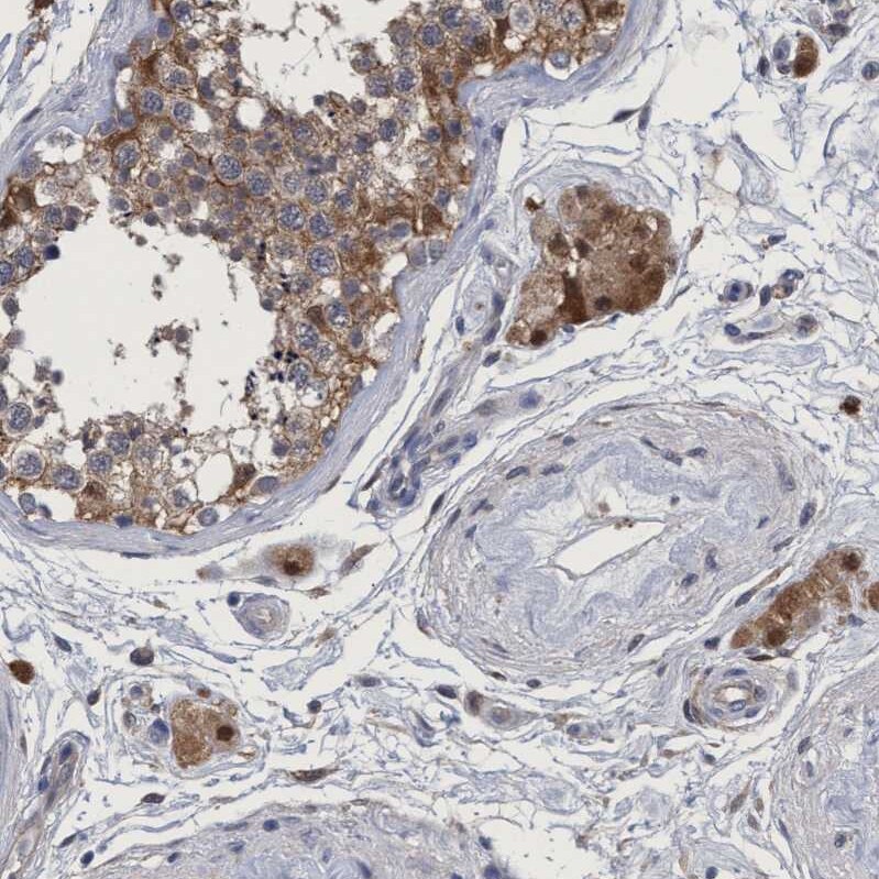 PNPO Antibody - BSA Free Immunohistochemistry-Paraffin: PNPO Antibody [NBP1-87303]