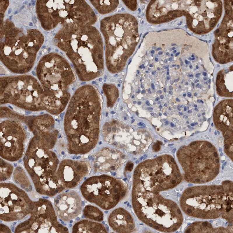 PNPO Antibody - BSA Free Immunohistochemistry-Paraffin: PNPO Antibody [NBP1-87303]