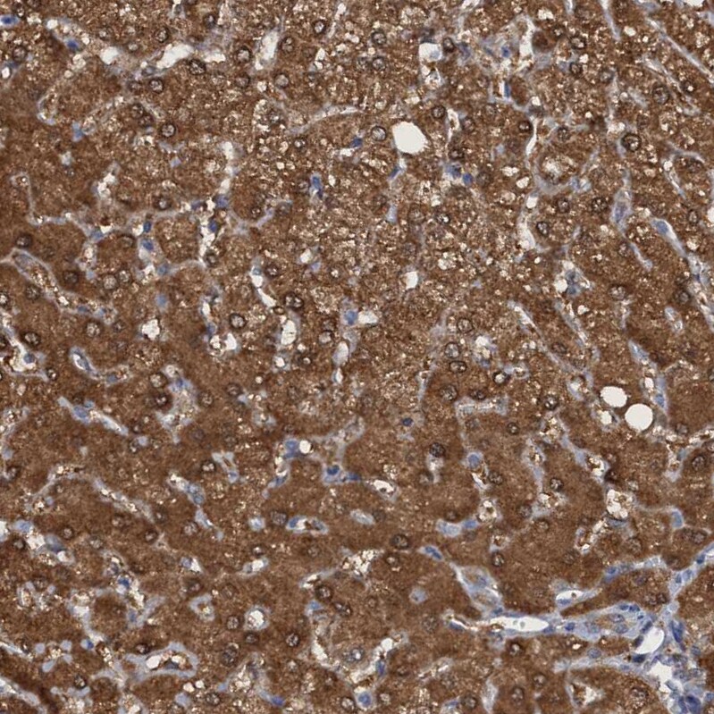 PNPO Antibody - BSA Free Immunohistochemistry-Paraffin: PNPO Antibody [NBP1-87303]