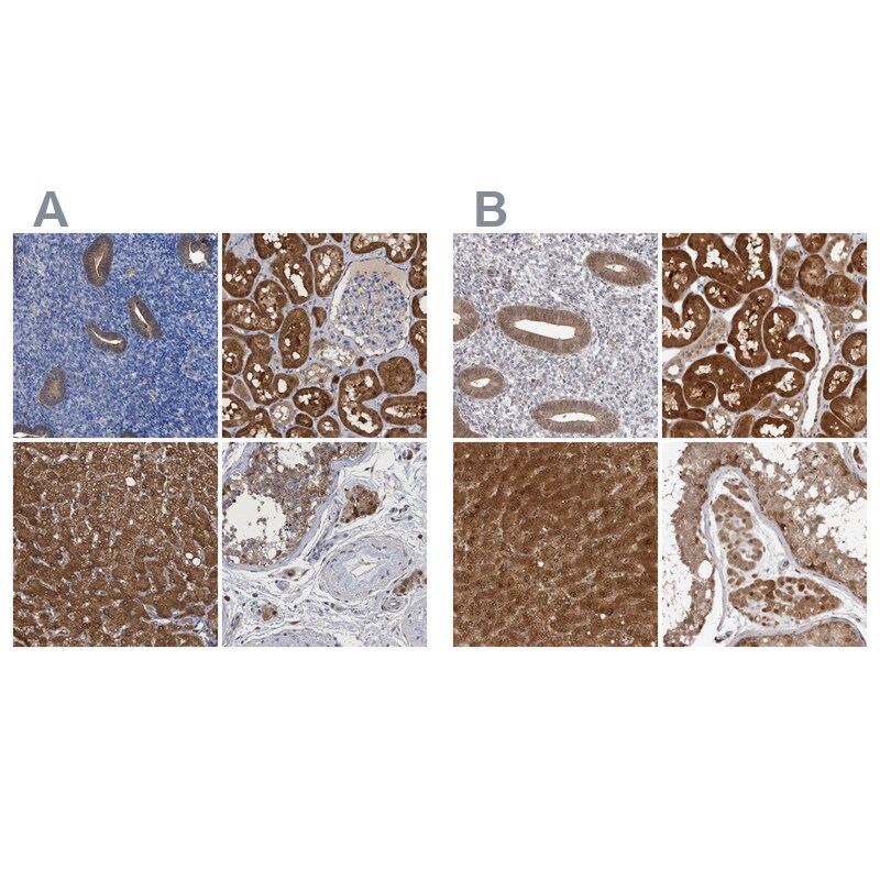 PNPO Antibody - BSA Free Immunohistochemistry-Paraffin: PNPO Antibody [NBP1-87303]