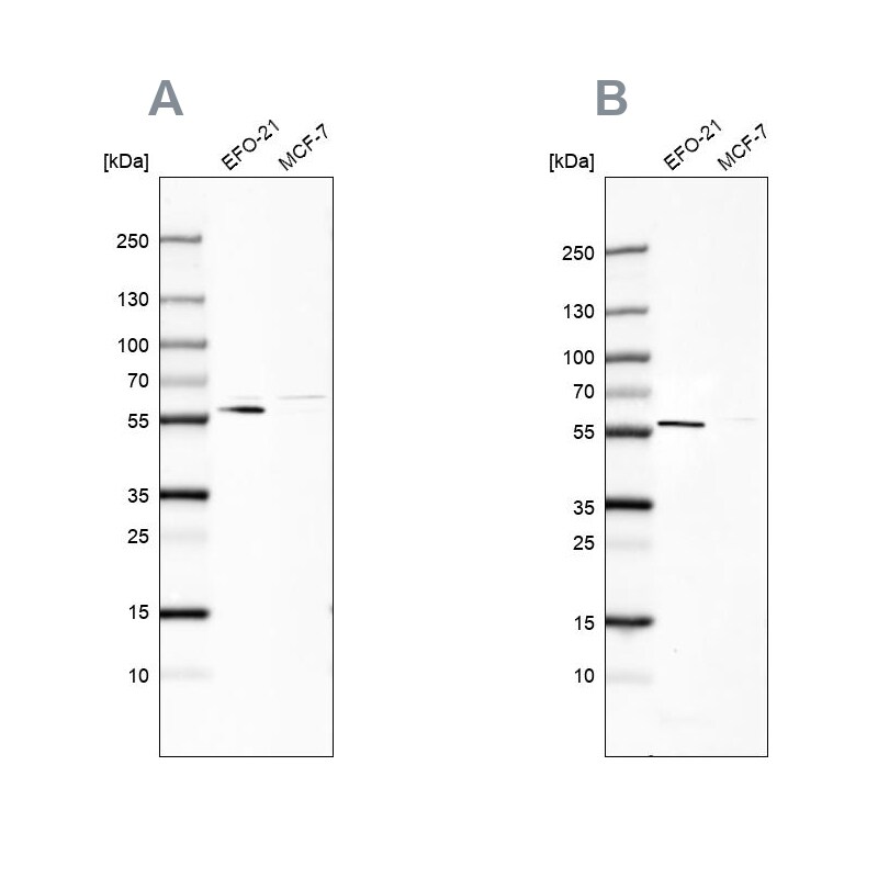 Pyruvate Dehydrogenase Phosphatase/PDP1/PPM2C Antibody Western Blot: Pyruvate Dehydrogenase Phosphatase/PDP1/PPM2C Antibody Antibody [NBP1-87308]