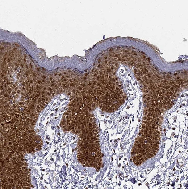 PHGDH Antibody - BSA Free Immunohistochemistry-Paraffin: PHGDH Antibody [NBP1-87310]