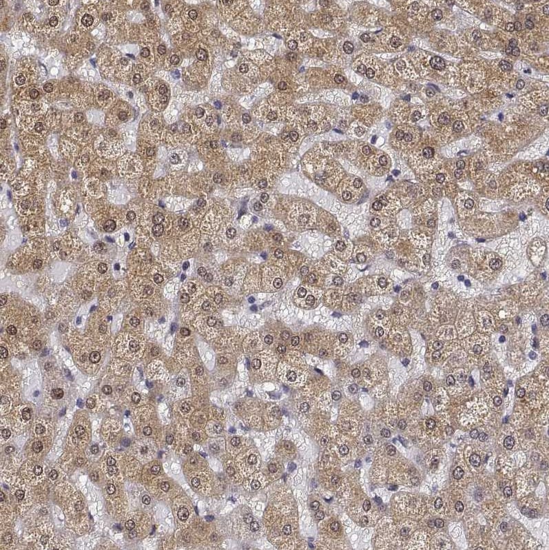 PHGDH Antibody - BSA Free Immunohistochemistry-Paraffin: PHGDH Antibody [NBP1-87310]