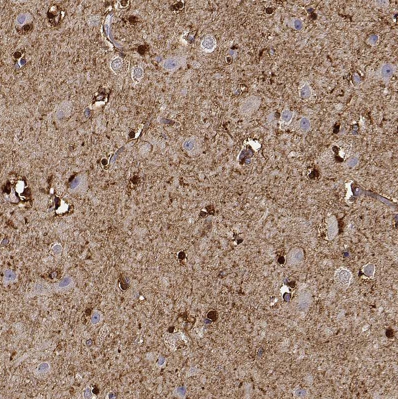 PHGDH Antibody - BSA Free Immunohistochemistry-Paraffin: PHGDH Antibody [NBP1-87310]