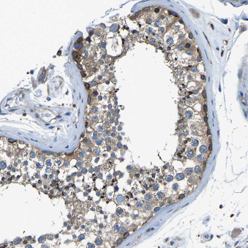 PCTAIRE2 Antibody - BSA Free Immunohistochemistry-Paraffin: PCTAIRE2 Antibody [NBP1-87316]
