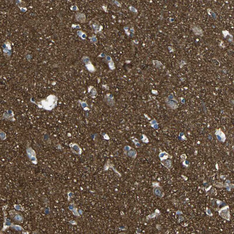 PCTAIRE2 Antibody - BSA Free Immunohistochemistry-Paraffin: PCTAIRE2 Antibody [NBP1-87316]