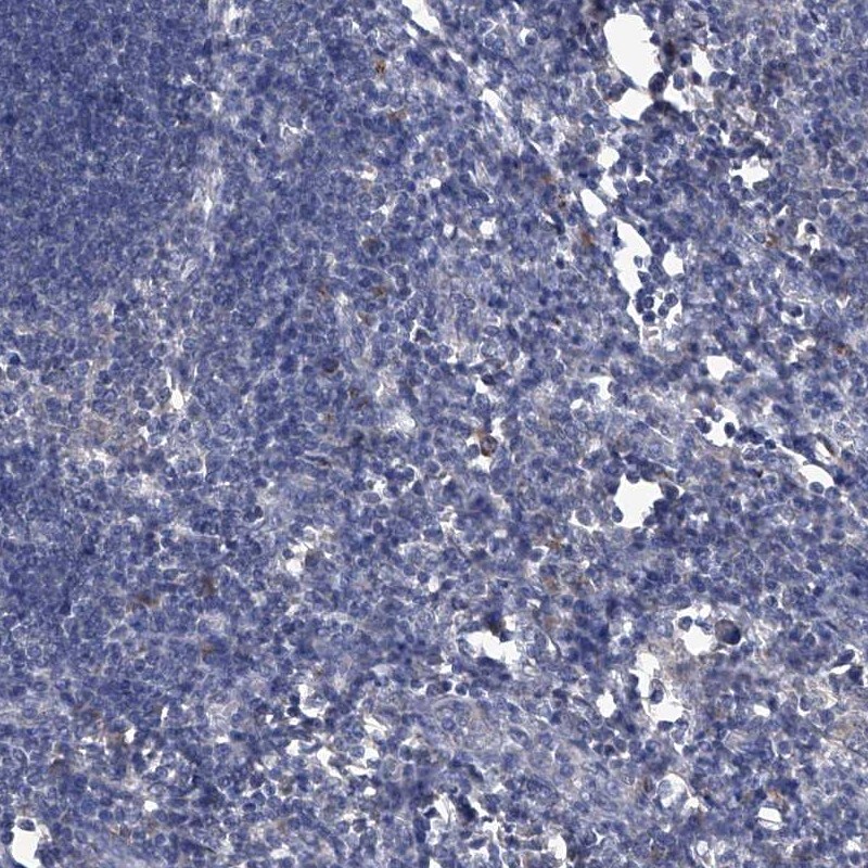 PC6 Antibody - BSA Free Immunohistochemistry-Paraffin: PC6 Antibody [NBP1-87326]