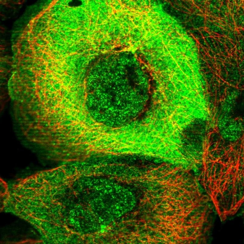 PARG1 Antibody - BSA Free Immunocytochemistry/ Immunofluorescence: PARG1 Antibody [NBP1-87336]