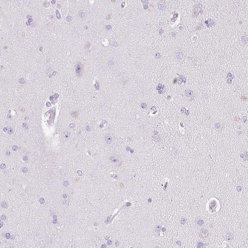 Pappalysin-2/PAPP-A2 Antibody - BSA Free Immunohistochemistry-Paraffin: Pappalysin-2/PAPP-A2 Antibody [NBP1-87339]