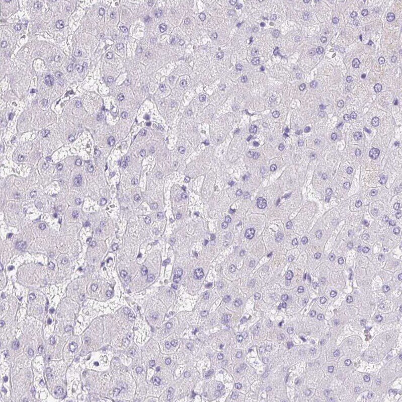 Pappalysin-2/PAPP-A2 Antibody - BSA Free Immunohistochemistry-Paraffin: Pappalysin-2/PAPP-A2 Antibody [NBP1-87339]
