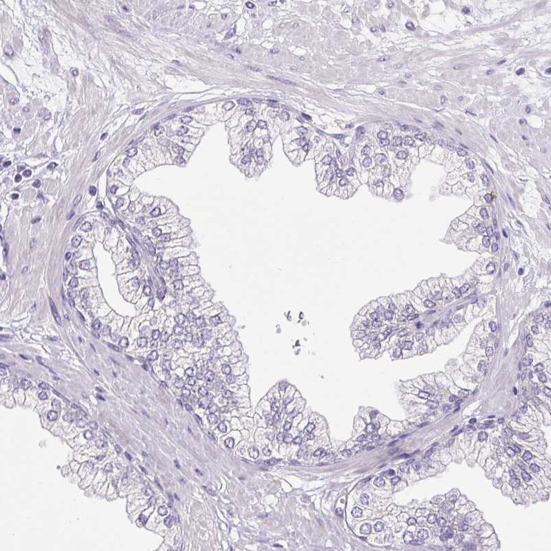 Pappalysin-2/PAPP-A2 Antibody - BSA Free Immunohistochemistry-Paraffin: Pappalysin-2/PAPP-A2 Antibody [NBP1-87339]