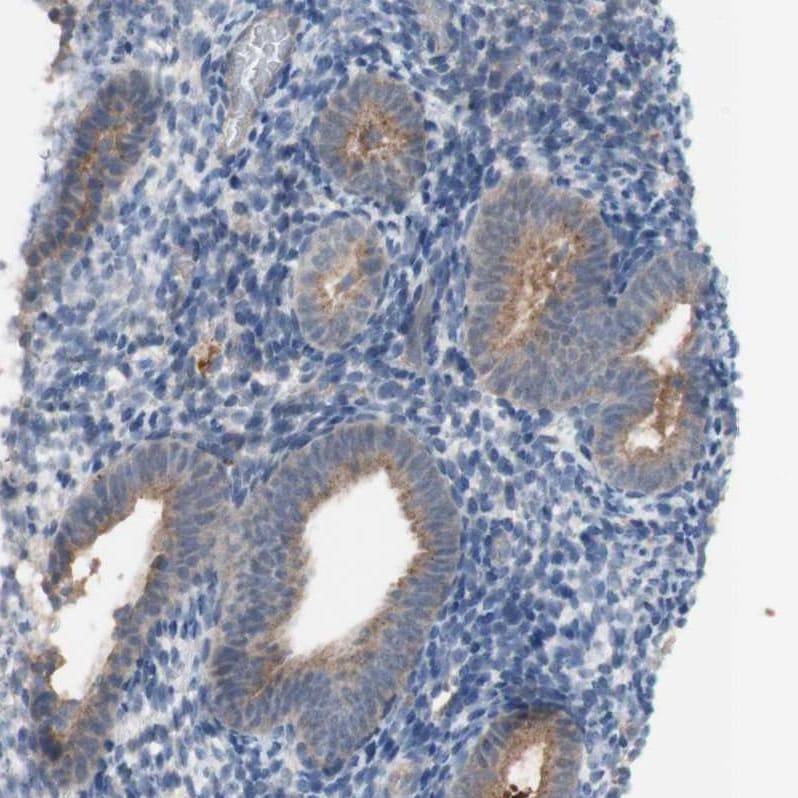 PXMP3 Antibody - BSA Free Immunohistochemistry: PXMP3 Antibody - BSA Free [NBP1-87352]