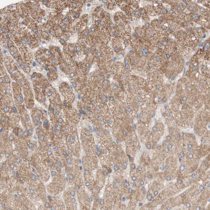 PXMP3 Antibody - BSA Free Immunohistochemistry: PXMP3 Antibody - BSA Free [NBP1-87352]