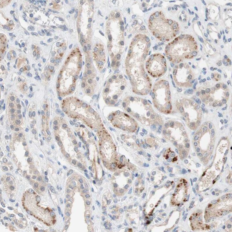 PXMP3 Antibody - BSA Free Immunohistochemistry: PXMP3 Antibody - BSA Free [NBP1-87352]