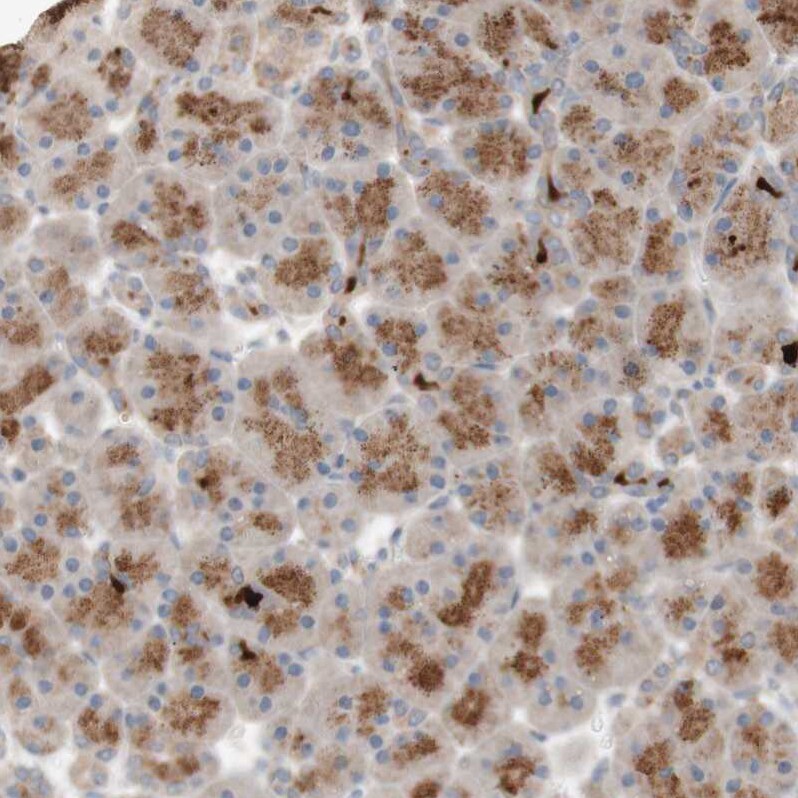 PXMP3 Antibody - BSA Free Immunohistochemistry: PXMP3 Antibody - BSA Free [NBP1-87352]