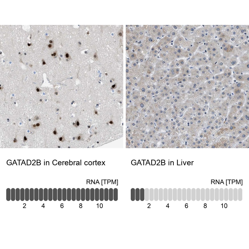 p66 beta Antibody - BSA Free Immunohistochemistry-Paraffin: p66 beta Antibody [NBP1-87358]