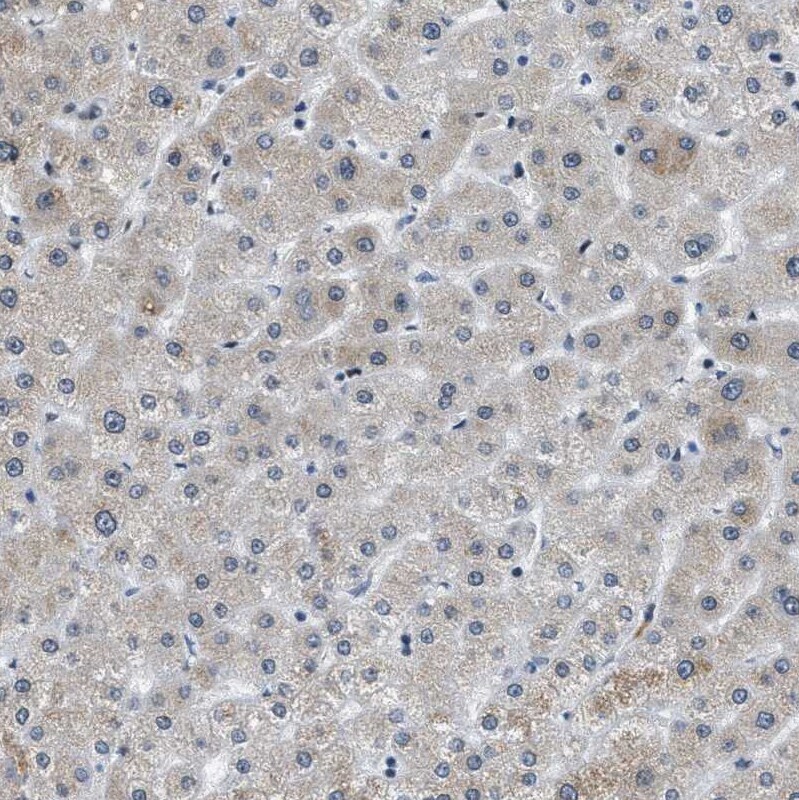 p66 beta Antibody - BSA Free Immunohistochemistry-Paraffin: p66 beta Antibody [NBP1-87358]