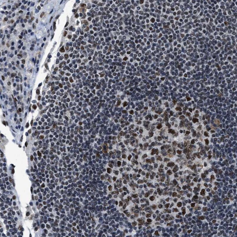 p66 beta Antibody - BSA Free Immunohistochemistry-Paraffin: p66 beta Antibody [NBP1-87358]