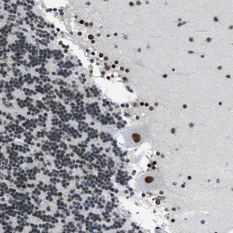 p66 beta Antibody - BSA Free Immunohistochemistry-Paraffin: p66 beta Antibody [NBP1-87358]
