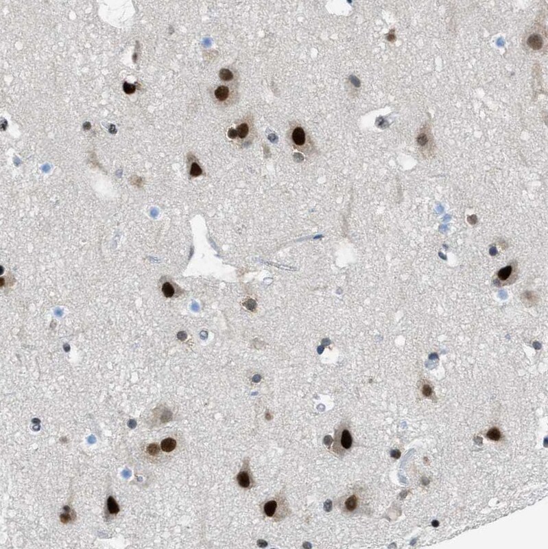p66 beta Antibody - BSA Free Immunohistochemistry-Paraffin: p66 beta Antibody [NBP1-87358]