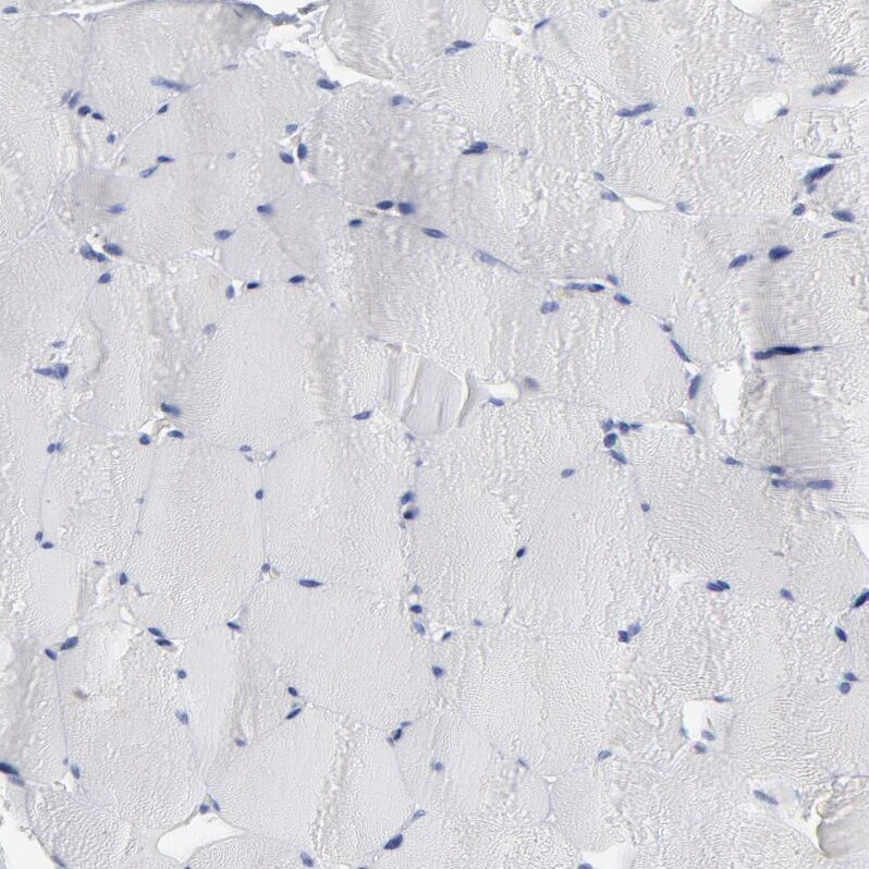 P2Y8 Antibody - BSA Free Immunohistochemistry-Paraffin: P2Y8 Antibody [NBP1-87375]