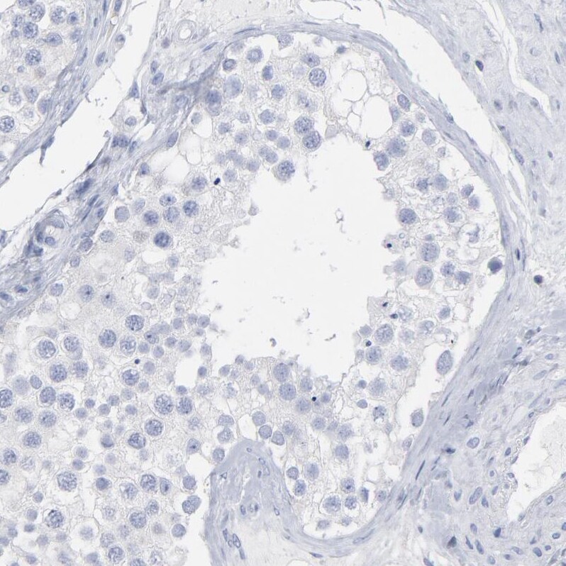 P2Y8 Antibody - BSA Free Immunohistochemistry-Paraffin: P2Y8 Antibody [NBP1-87375]