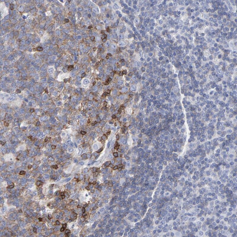 P2Y8 Antibody - BSA Free Immunohistochemistry-Paraffin: P2Y8 Antibody [NBP1-87375]