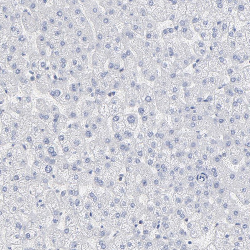 P2Y8 Antibody - BSA Free Immunohistochemistry-Paraffin: P2Y8 Antibody [NBP1-87375]
