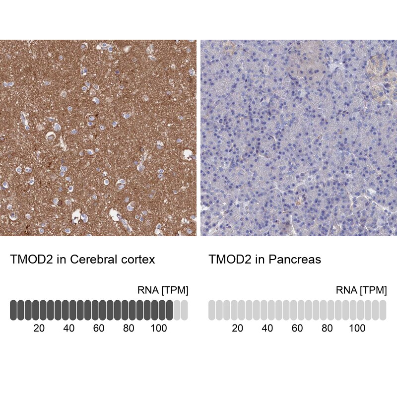 Tropomodulin 2 Antibody - BSA Free Immunohistochemistry-Paraffin: Tropomodulin 2 Antibody [NBP1-87378]