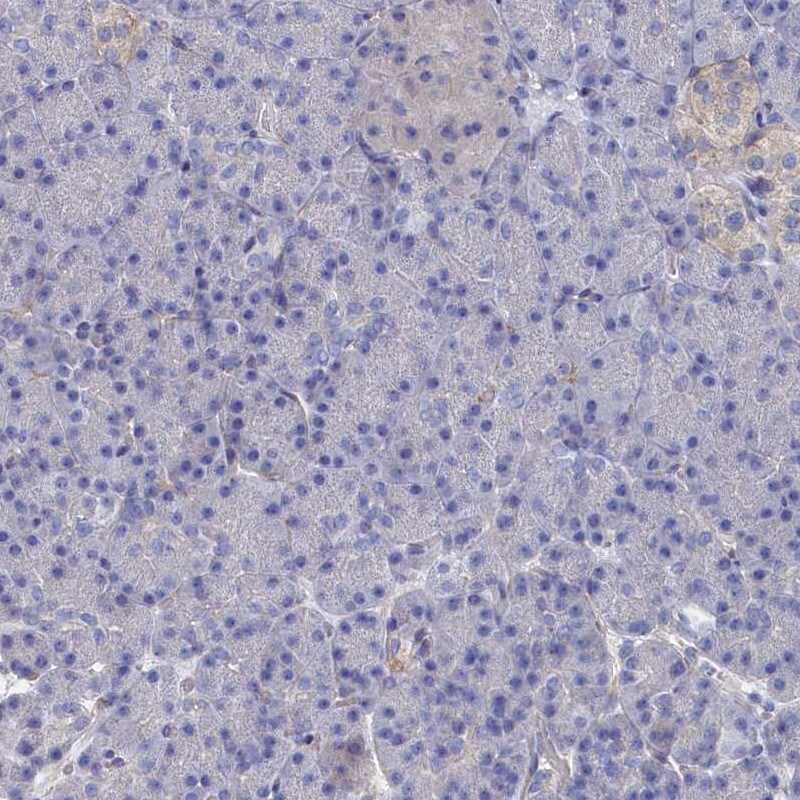 Tropomodulin 2 Antibody - BSA Free Immunohistochemistry-Paraffin: Tropomodulin 2 Antibody [NBP1-87378]