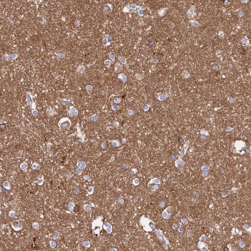 Tropomodulin 2 Antibody - BSA Free Immunohistochemistry-Paraffin: Tropomodulin 2 Antibody [NBP1-87378]