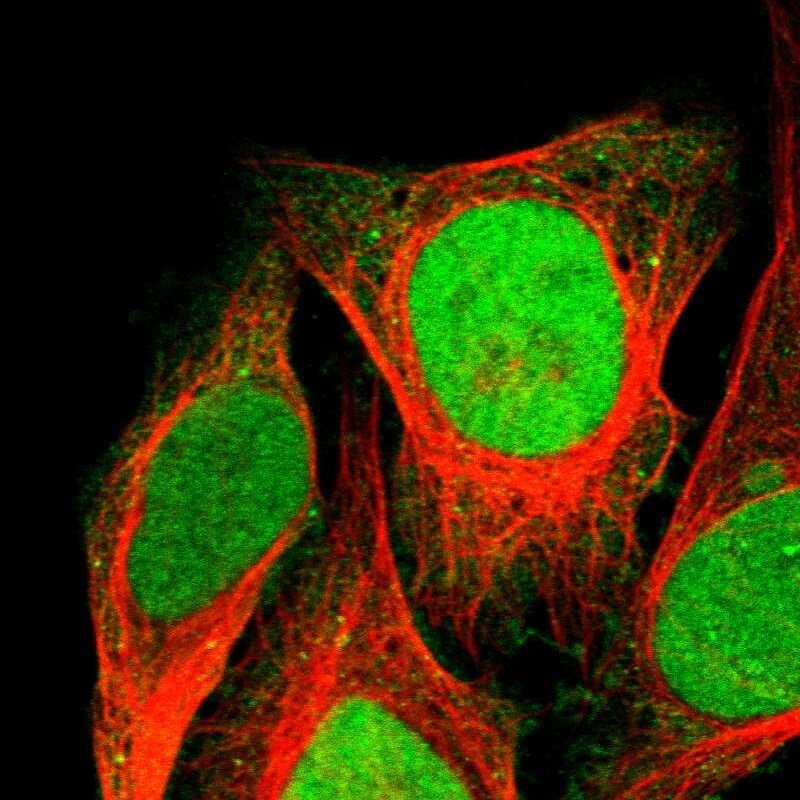 NSBP1 Antibody - BSA Free Immunocytochemistry/ Immunofluorescence: NSBP1 Antibody [NBP1-87379]