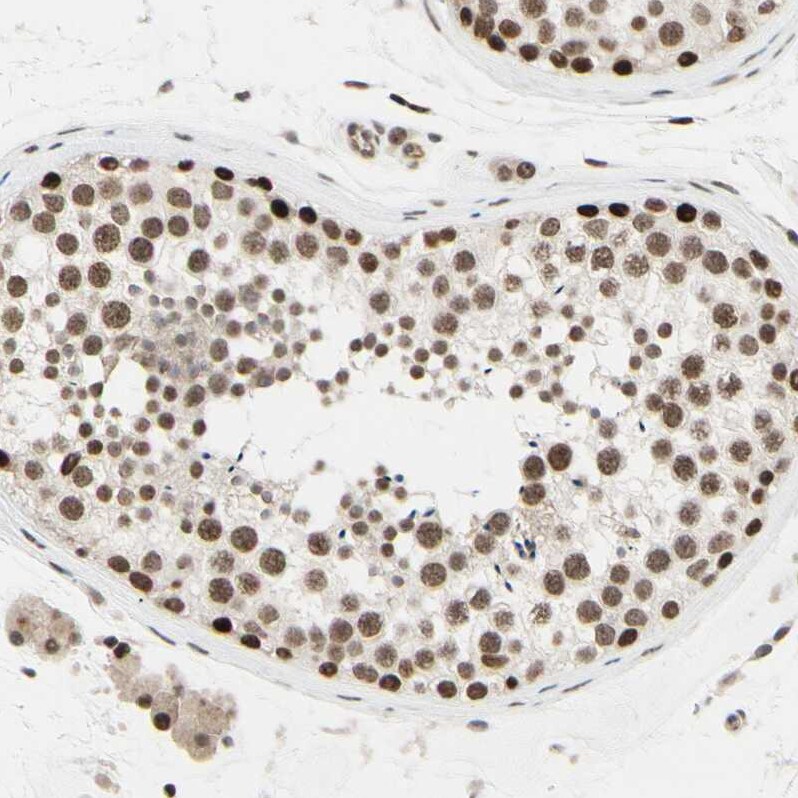 Suppressor of Fused Antibody - BSA Free Immunohistochemistry-Paraffin: Suppressor of Fused Antibody [NBP1-87384]