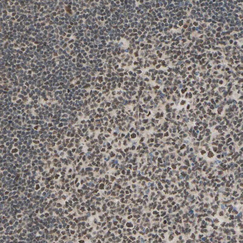 Suppressor of Fused Antibody - BSA Free Immunohistochemistry-Paraffin: Suppressor of Fused Antibody [NBP1-87384]