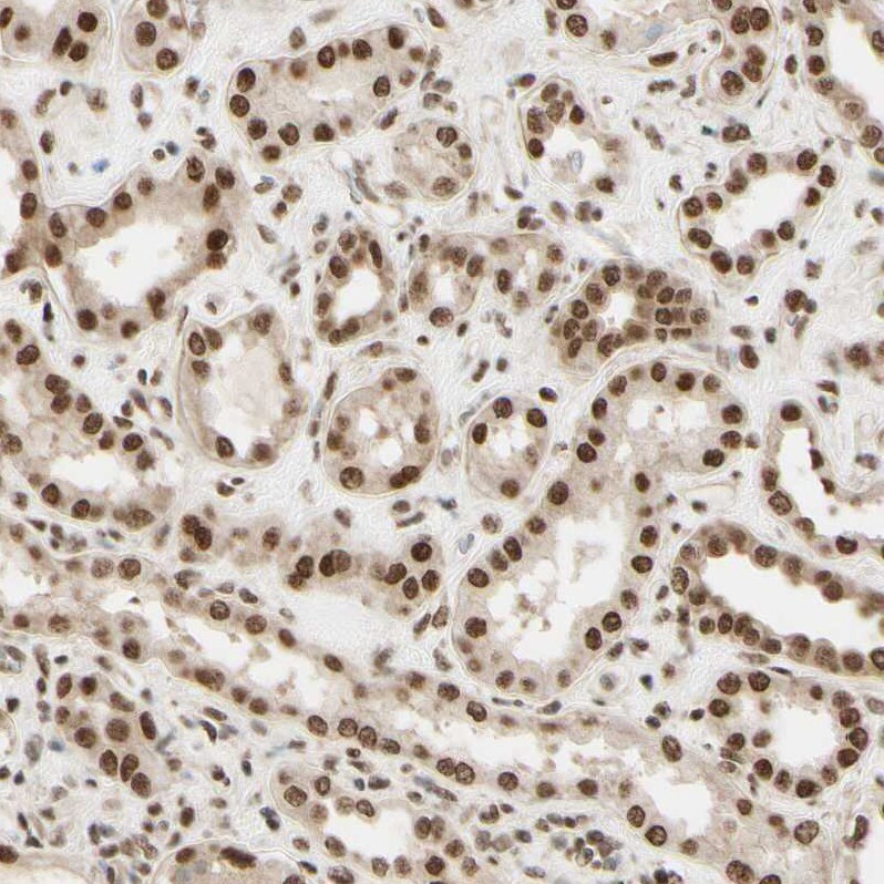 Suppressor of Fused Antibody - BSA Free Immunohistochemistry-Paraffin: Suppressor of Fused Antibody [NBP1-87384]