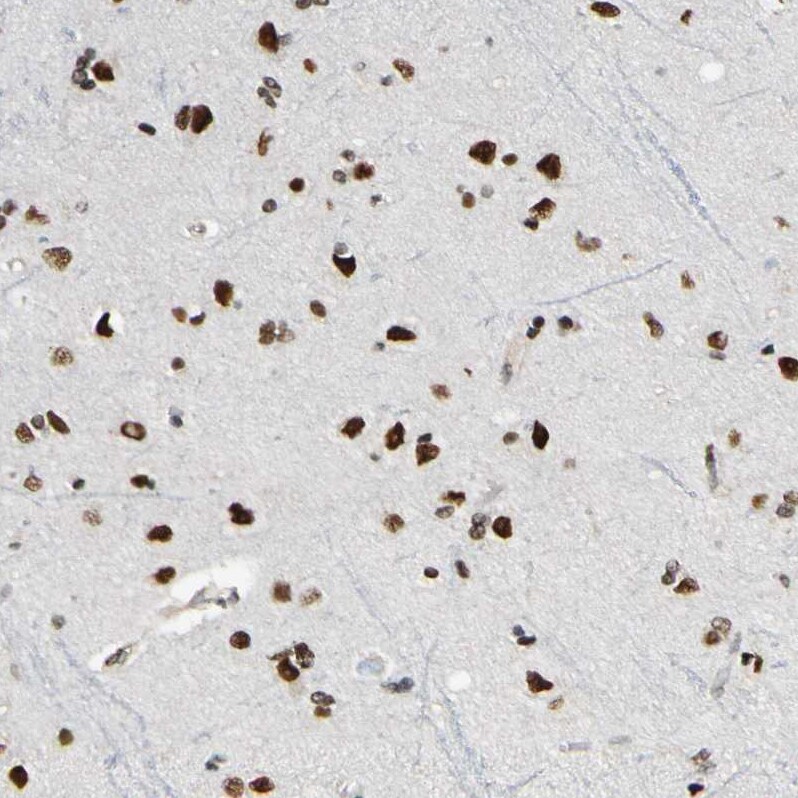 Suppressor of Fused Antibody - BSA Free Immunohistochemistry-Paraffin: Suppressor of Fused Antibody [NBP1-87384]