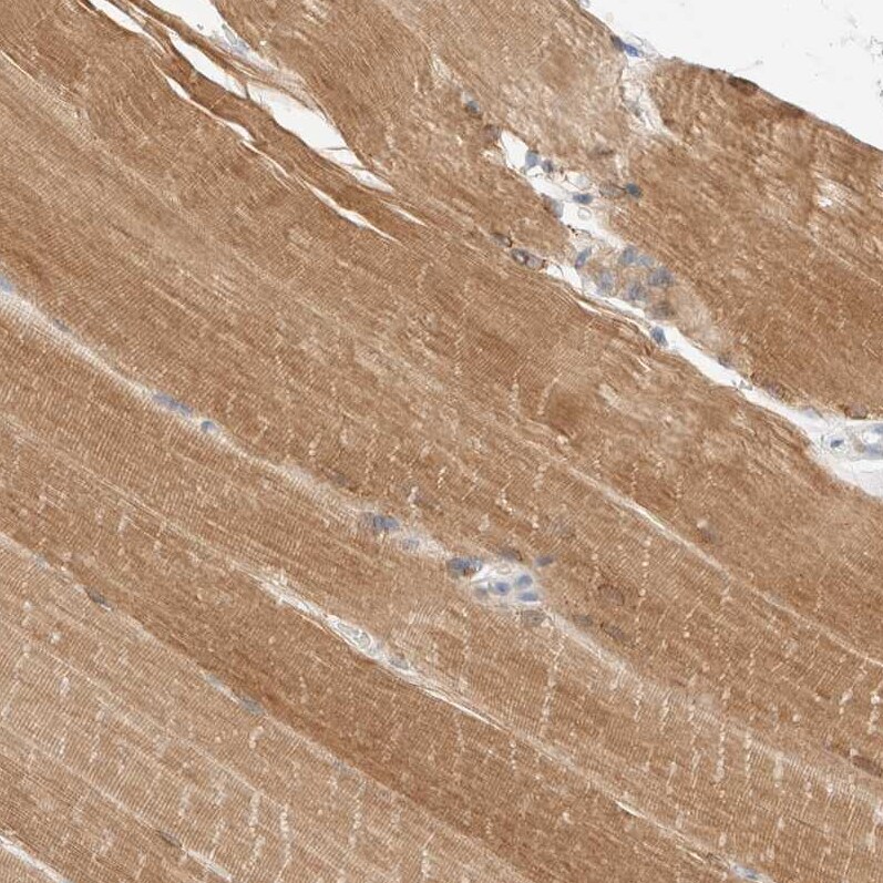Delta 1 Tubulin Antibody - BSA Free Immunohistochemistry-Paraffin: Delta 1 Tubulin Antibody [NBP1-87391]