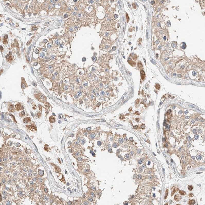 Delta 1 Tubulin Antibody - BSA Free Immunohistochemistry-Paraffin: Delta 1 Tubulin Antibody [NBP1-87391]