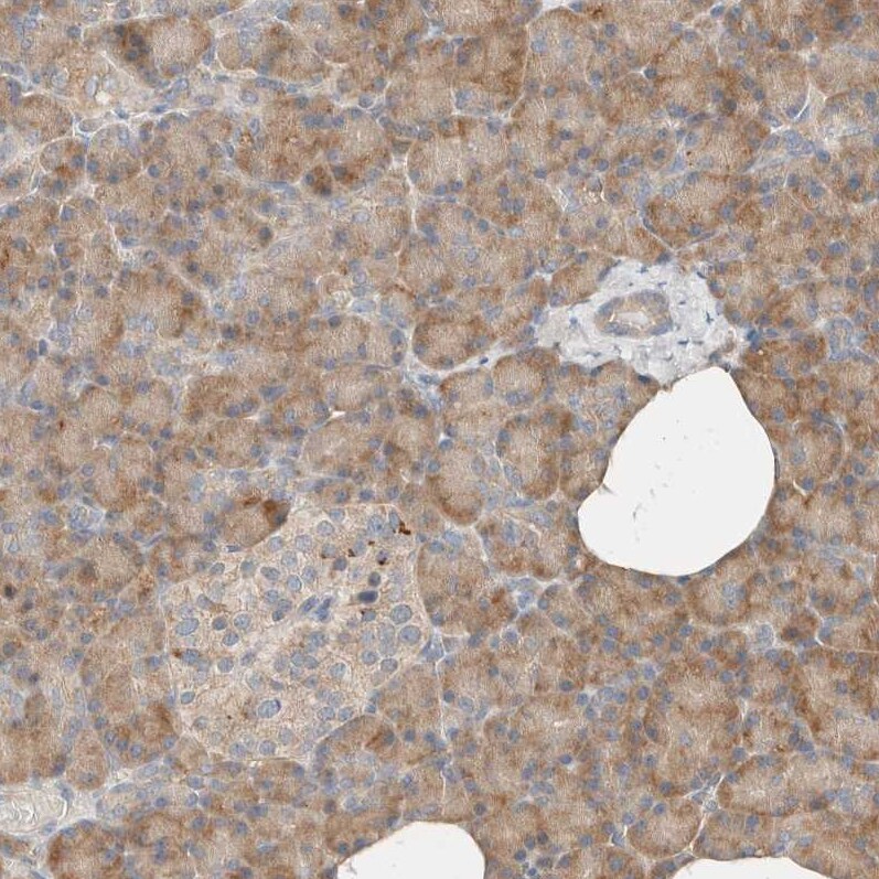 Delta 1 Tubulin Antibody - BSA Free Immunohistochemistry-Paraffin: Delta 1 Tubulin Antibody [NBP1-87391]